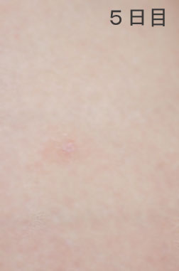molte15.jpg molte15.jpg